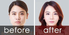 https://img.yiyiaimei.com/timg/160222/1F224O39-0.jpg