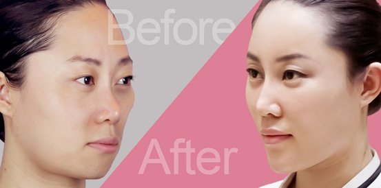 https://img.yiyiaimei.com/timg/160222/1F449C20-0.jpg