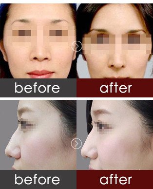 https://img.yiyiaimei.com/timg/160222/1F53W233-1.jpg