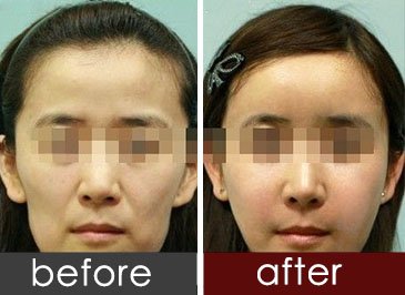 https://img.yiyiaimei.com/timg/160222/1G2516107-0.jpg