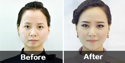案例图片