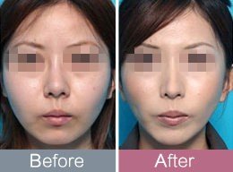 https://img.yiyiaimei.com/timg/160222/1G32340S-0.jpg