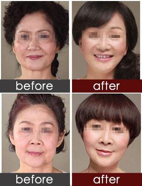 https://img.yiyiaimei.com/timg/160222/1G3423217-0.jpg