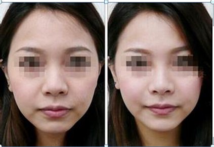 案例图片
