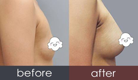 https://img.yiyiaimei.com/timg/160222/1G54643N-0.jpg