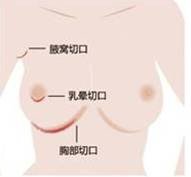 https://img.yiyiaimei.com/timg/160222/1G6202G3-0.jpg