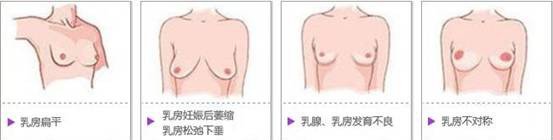 案例图片