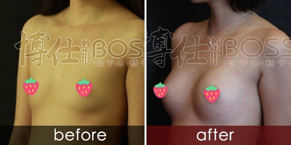 https://img.yiyiaimei.com/timg/160222/1G6292b3-1.jpg