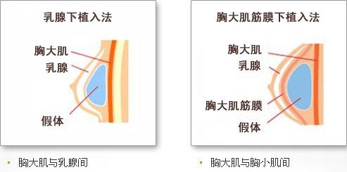 案例图片
