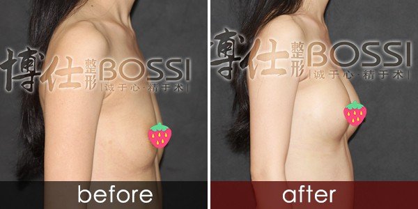 https://img.yiyiaimei.com/timg/160222/1G6302258-2.jpg