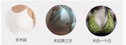 https://img.yiyiaimei.com/timg/160222/1G921K00-0.jpg