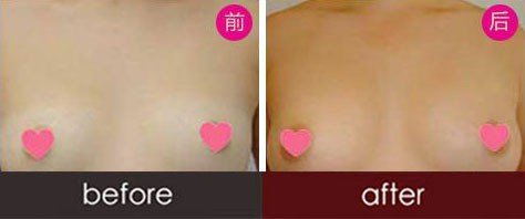 案例图片