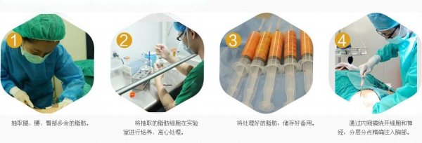 案例图片
