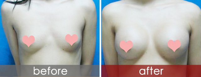 案例图片