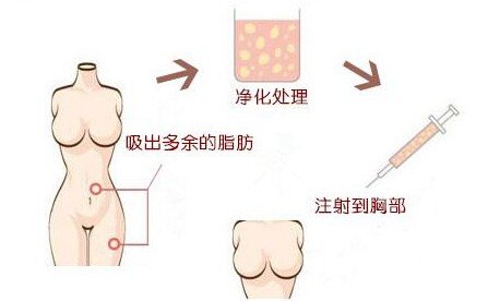 案例图片