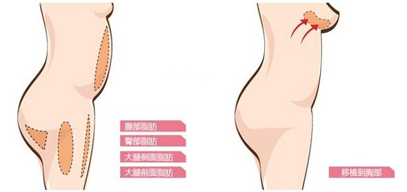 案例图片