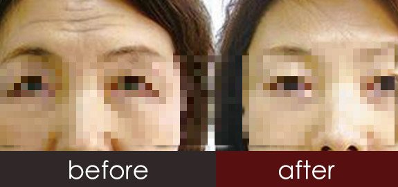 https://img.yiyiaimei.com/timg/160222/1H25M3C-0.jpg