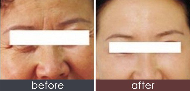 https://img.yiyiaimei.com/timg/160222/1H3103325-0.jpg