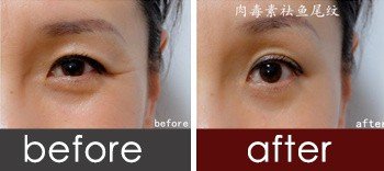 https://img.yiyiaimei.com/timg/160222/1H31R214-0.jpg