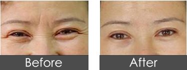 https://img.yiyiaimei.com/timg/160222/1I4043117-0.jpg