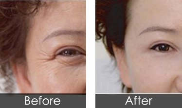 https://img.yiyiaimei.com/timg/160222/1I4055095-1.jpg