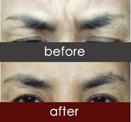 https://img.yiyiaimei.com/timg/160222/1I4141648-0.jpg