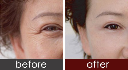 https://img.yiyiaimei.com/timg/160222/1I41444P-0.jpg