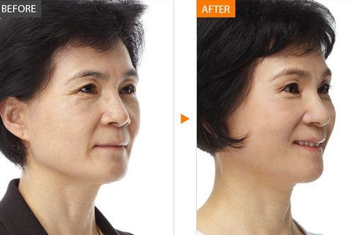 https://img.yiyiaimei.com/timg/160222/1I4204I7-0.jpg