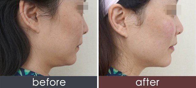https://img.yiyiaimei.com/timg/160222/1I503J23-0.jpg