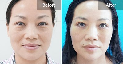 https://img.yiyiaimei.com/timg/160222/1I5062L0-0.jpg