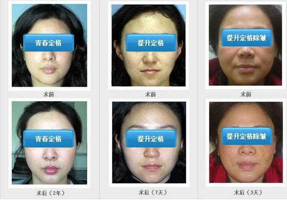 https://img.yiyiaimei.com/timg/160222/1I51323b-0.jpg