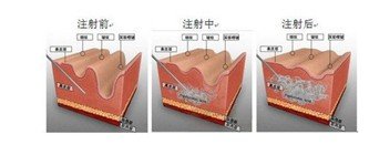 案例图片