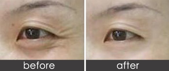https://img.yiyiaimei.com/timg/160222/1I55622T-0.jpg