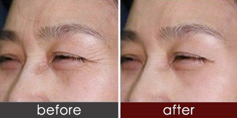 https://img.yiyiaimei.com/timg/160222/1I614L29-0.jpg