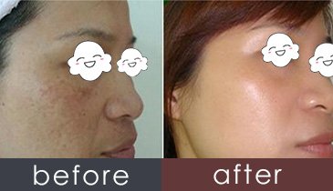 https://img.yiyiaimei.com/timg/160222/1P2022606-1.jpg