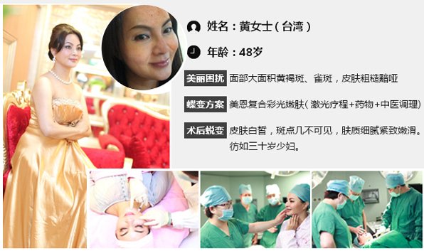 案例图片
