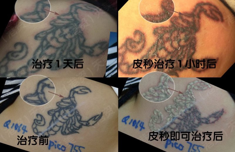 https://img.yiyiaimei.com/timg/160222/1P3312215-0.jpg