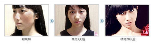 案例图片